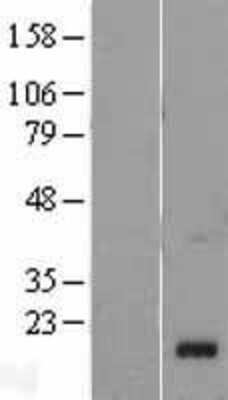 Western Blot Chemerin Overexpression Lysate