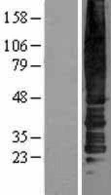 Western Blot CC Chemokine Receptor D6 Overexpression Lysate