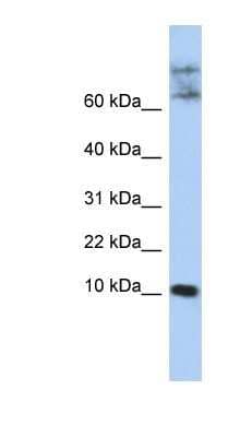 Western Blot: Chemokine-like factor Antibody [NBP1-59506] - Jurkat cell lysate, concentration 0.2-1 ug/ml.