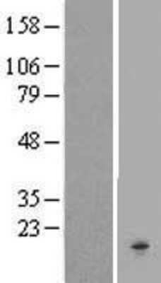 Western Blot: Chemokine-like factor Overexpression Lysate (Adult Normal) [NBL1-09219] Left-Empty vector transfected control cell lysate (HEK293 cell lysate); Right -Over-expression Lysate for Chemokine-like factor.