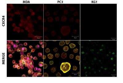 Immunocytochemistry/Immunofluorescence: Chemotherapy Insensitive Tumor Cells Antibody Pack [NBP1-78942] - Optimization of immunofluorescence staining of CXCR4 protein. Cells were seeded onto cell-tak coated 48 mm coverslips in a 48-well plate. Cells were fixed with 2% formaldehyde for 20 min, washed with PBS. After fixation, cells were blocked with 2.0% BSA in PBS for 1 h at room temperature. All the cells were incubated with a primary antibody for anti-rabbit CXCR4 for 1 h. After washing with PBS, cells were put in respective secondary antibodies-anti-rabbit dylight 405 for 1 h. PSMA= Magenta, EpCAM= Yellow, sLex= Green, CXCR4= Red, and Merge shows all the colors. MDA=PSMA+, EpCAM+, sLex+, CXCR4+. PC3 = PSMA-, EpCAM+, sLex-, CXCR4+. KG1 = PSMA-, EpCAM-, sLex+, CXCR4-. Image collected and cropped by CiteAb from the following publication (//doi.org/10.1371/journal.pone.0085143) licensed under a CC-BY license. Anti-CXCR4 antibody (NB100-74396)