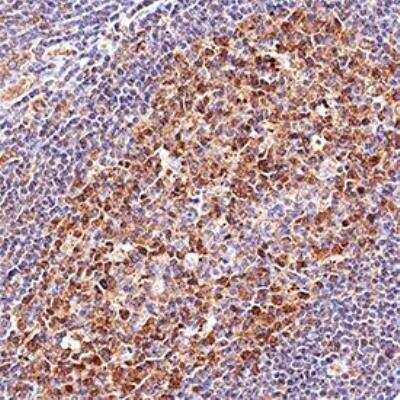 Immunohistochemistry: Chemotherapy Insensitive Tumor Cells Antibody Pack [NBP1-78942] - IHC analysis of formalin fixed paraffin-embedded (FFPE) human tonsil using LMO2 antibody (NB110-78626) at 1:500 on a Bond Rx autostainer (Leica Biosystems). The assay involved 20 minutes of heat induced antigen retrieval (HIER) using 10mM sodium citrate buffer (pH 6.0) and endogenous peroxidase quenching with peroxide block. The sections were incubated with primary antibody for 30 minutes and Bond Polymer Refine Detection (Leica Biosystems) with DAB was used for signal development followed by counterstaining with hematoxylin. Whole slide scanning and capturing of representative images was performed using Aperio AT2 (Leica Biosystems). Nuclear with some cytoplasmic staining was observed. Staining was performed by Histowiz.