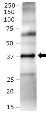 Western Blot: Chemotherapy Insensitive Tumor Cells Antibody Pack [NBP1-78942] - Analysis of CXCR4 protein in human small intestine tissue lysate using 1:500 dilution of rabbit polyclonal CXCR4 antibody (NB100-74396). The signal was developed using ECL method and the antibody generated a specific band of CXCR4 at ~40 kDa position.