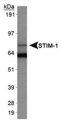 Western Blot: Chemotherapy Insensitive Tumor Cells Antibody Pack [NBP1-78942] - Detection of STIM1 in HeLa whole cell extracts using NB110-60547.