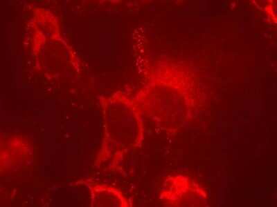 Immunocytochemistry/Immunofluorescence: Chicken anti-Mouse IgG (H+L) Secondary Antibody [DyLight 594] [NBP1-75555] - Analysis of Laminin in Vero cells using Chicken anti-Mouse IgG (H+L) Secondary Antibody [DyLight 594]. Cells were fixed in 4% formaldehyde for 20 minutes at room temperature. Image from verified customer review.