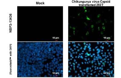 Immunocytochemistry/Immunofluorescence: Chikungunya Virus Capsid Antibody [NBP3-13436] - Chikungunya Virus Capsid antibody detects Chikungunya Virus Capsid protein at cytoplasm by immunofluorescent analysis. Sample: Mock and transfected 293T cells were fixed in 4% paraformaldehyde at RT for 15 min. Green: Chikungunya Virus Capsid stained by Chikungunya Virus Capsid antibody (NBP3-13436) diluted at 1:2000.