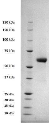 SDS-PAGE Recombinant Virus Chikungunya Virus E1 His (C-Term) Protein