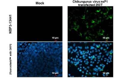 Immunocytochemistry/Immunofluorescence: Chikungunya Virus nsp1 Antibody [NBP3-13441] - Chikungunya Virus nsp1 antibody detects Chikungunya Virus nsp1 protein at cytoplasm by immunofluorescent analysis. Sample: Mock and transfected 293T cells were fixed in 4% paraformaldehyde at RT for 15 min. Green: Chikungunya Virus nsp1 stained by Chikungunya Virus nsp1 antibody (NBP3-13441) diluted at 1:2000.