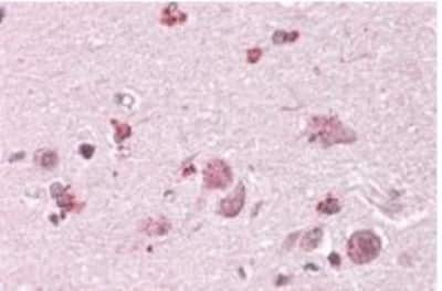 Immunohistochemistry-Paraffin: Chimaerin 2 Antibody [NBP1-36945] - 3.8ug/ml staining of paraffin embedded Human Cortex. Steamed antigen retrieval with citrate buffer pH 6, AP-staining.