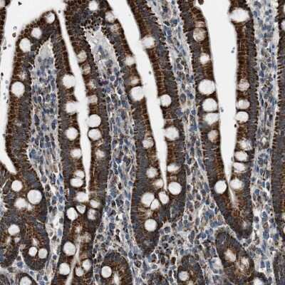 Immunohistochemistry-Paraffin: Chimaerin 2 Antibody [NBP1-90108] - Staining of human duodenum shows strong cytoplasmic positivity in glandular cells.