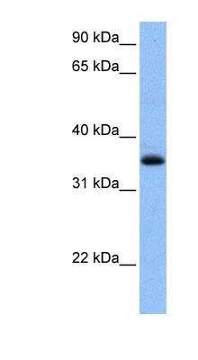 Western Blot: Chimaerin 2 Antibody [NBP1-55094] - Human Liver cell lysate, concentration 0.2-1 ug/ml.