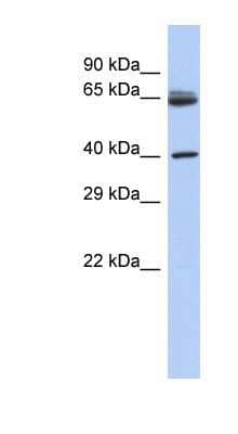 Western Blot: Chimaerin 2 Antibody [NBP1-55257] - Human Thymus lysate, concentration 0.2-1 ug/ml.