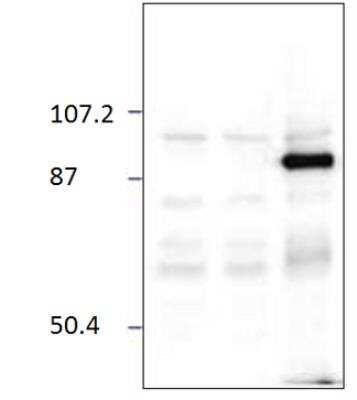 Western Blot: Chimaerin 2 Antibody [NBP3-12460] - WB 1:500 dilution