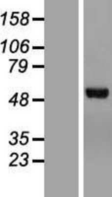 Western Blot: Chimaerin 2 Overexpression Lysate (Adult Normal) [NBL1-09166] Left-Empty vector transfected control cell lysate (HEK293 cell lysate); Right -Over-expression Lysate for Chimaerin 2.