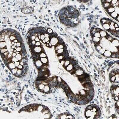 Immunohistochemistry-Paraffin: Chitinase 3-like 2 Antibody [NBP1-86845] - Staining of human stomach shows strong cytoplasmic positivity in glandular cells.