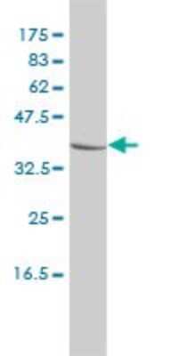 Western Blot: Chitobiase/CTBS Antibody (1B5-1B9) [H00001486-M01] - CTBS monoclonal antibody (M01), clone 1B5-1B9 Analysis of CTBS expression in MCF-7.