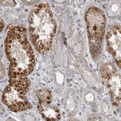 Immunohistochemistry-Paraffin: Chitobiase/CTBS Antibody [NBP1-85388] - Staining of human kidney shows strong granular cytoplasmic positivity in subset of cells in tubules.
