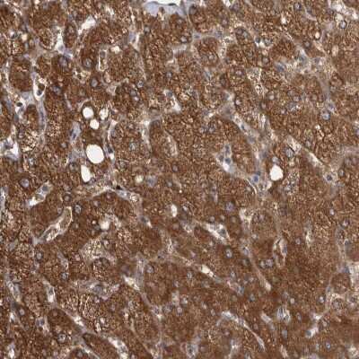 Immunohistochemistry-Paraffin: Chitobiase/CTBS Antibody [NBP1-85388] - Staining of human liver shows strong granular cytoplasmic positivity in hepatocytes.