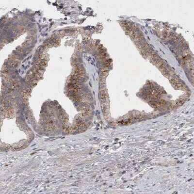 Immunohistochemistry-Paraffin: Chitobiase/CTBS Antibody [NBP1-85388] - Staining of human prostate shows moderate granular cytoplasmic positivity in glandular cells.