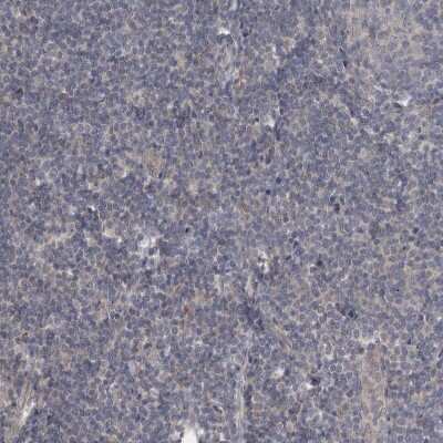 Immunohistochemistry-Paraffin: Chitobiase/CTBS Antibody [NBP1-85388] - Staining of human tonsil shows no positivity in non-germinal center cells as expected.