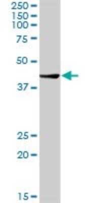 Western Blot: Chitobiase/CTBS Antibody [H00001486-D01P] - Analysis of CTBS expression in human liver.
