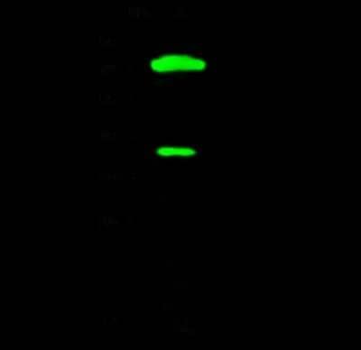 Western Blot: Chitobiase/CTBS Antibody [NBP2-99190] - Anti-Chitobiase/CTBS rabbit polyclonal antibody at 1:500 dilution. Lane A: MCF7 Whole Cell Lysate. Lysates/proteins at 30 ug per lane. Secondary Goat Anti- Rabbit IgG H&L (Dylight 800) at 1/10000 dilution. Developed using the Odyssey technique. Performed under reducing conditions. Predicted band size: 44 kDa. Observed band size: 40 kDa (We are unsure as to the identity of these extra bands).