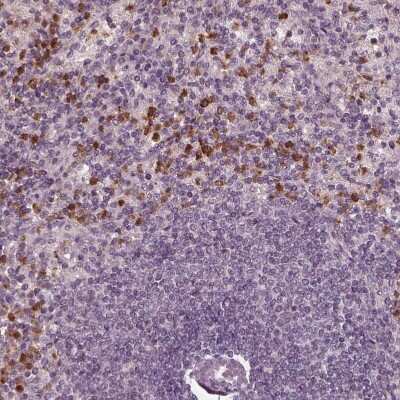 Immunohistochemistry-Paraffin: Chitotriosidase/CHIT1 Antibody [NBP1-84490] - Staining of human spleen shows moderate to strong cytoplasmic positivity in cells in red pulp.