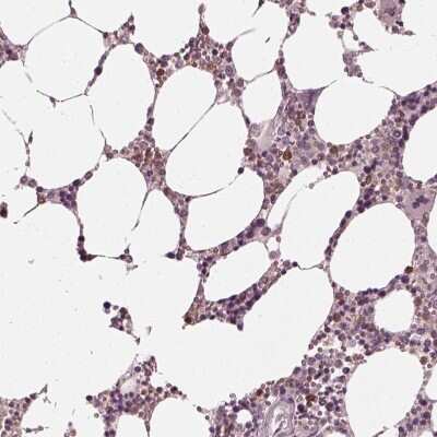 Immunohistochemistry-Paraffin: Chitotriosidase/CHIT1 Antibody [NBP1-84490] - Staining of human bone marrow shows moderate cytoplasmic positivity in hematopoietic cells.