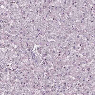 Immunohistochemistry-Paraffin: Chitotriosidase/CHIT1 Antibody [NBP1-84490] - Staining of human liver shows no positivity in hepatocytes as expected.