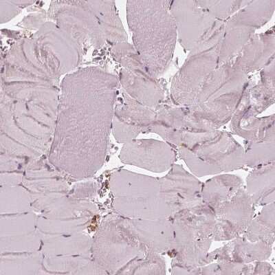 Immunohistochemistry-Paraffin: Chitotriosidase/CHIT1 Antibody [NBP1-84490] - Staining of human skeletal muscle shows no positivity in myocytes as expected.