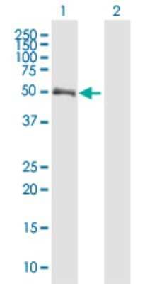 Western Blot: Chitotriosidase/CHIT1 Antibody [H00001118-B01P] - Analysis of CHIT1 expression in transfected 293T cell line by CHIT1 polyclonal antibody.  Lane 1: CHIT1 transfected lysate(51.26 KDa). Lane 2: Non-transfected lysate.