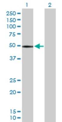 Western Blot: Chitotriosidase/CHIT1 Antibody [H00001118-D01P] - Analysis of CHIT1 expression in transfected 293T cell line by CHIT1 polyclonal antibody.Lane 1: CHIT1 transfected lysate(51.70 KDa).Lane 2: Non-transfected lysate.
