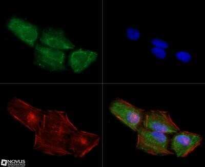 Immunocytochemistry/Immunofluorescence: Chk1 Antibody (2G1D5) - Azide and BSA Free [NBP2-80668] - Chk1 antibody was tested at 1:10 in HeLa cells with DyLight 488 (green). Nuclei and alpha-tubulin were counterstained with DAPI (blue) and Dylight 550 (red). Image objective 40X. Image from the standard format of this antibody.