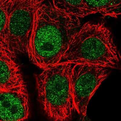 Immunocytochemistry/Immunofluorescence: Chk1 Antibody [NBP2-58441] - Staining of human cell line MCF7 shows localization to nucleoplasm.