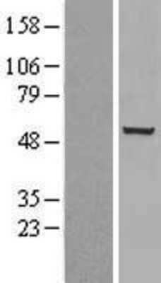 Western Blot: Chk1 Overexpression Lysate (Adult Normal) [NBL1-09146] Left-Empty vector transfected control cell lysate (HEK293 cell lysate); Right -Over-expression Lysate for Chk1.