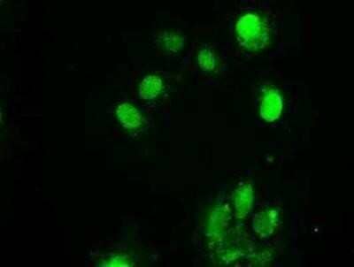 Immunocytochemistry/ Immunofluorescence Chk2 Antibody (OTI5C4) - Azide and BSA Free