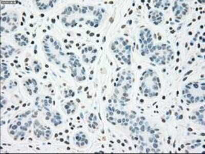 Immunohistochemistry: Chk2 Antibody (OTI5C4) - Azide and BSA Free [NBP2-71688] - Staining of paraffin-embedded Human breast tissue using anti-Chk2 mouse monoclonal antibody.