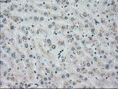 Immunohistochemistry: Chk2 Antibody (OTI5C4) - Azide and BSA Free [NBP2-71688] - Staining of paraffin-embedded Human liver tissue using anti-Chk2 mouse monoclonal antibody.