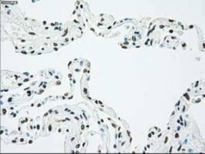 Immunohistochemistry: Chk2 Antibody (OTI5C4) - Azide and BSA Free [NBP2-71688] - Staining of paraffin-embedded Human lung tissue using anti-Chk2 mouse monoclonal antibody.