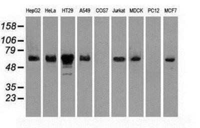 Western Blot Chk2 Antibody (OTI5C4) - Azide and BSA Free