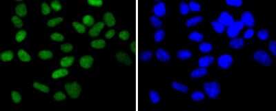 Immunocytochemistry/Immunofluorescence: Chk2 Antibody (SC604) [NBP2-67595] - Staining Chk2 in 293 cells (green). The nuclear counter stain is DAPI (blue). Cells were fixed in paraformaldehyde, permeabilised with 0.25% Triton X100/PBS.