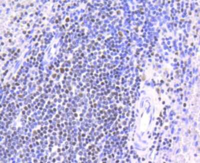 Immunohistochemistry-Paraffin: Chk2 Antibody (SC604) [NBP2-67595] - Analysis of paraffin-embedded human spleen tissue using anti-Chk2 antibody. Counter stained with hematoxylin.
