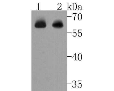 Western Blot: Chk2 Antibody (SC604) [NBP2-67595] - Western blot analysis of Chk2 on different lysates. Proteins were transferred to a PVDF membrane and blocked with 5% BSA in PBS for 1 hour at room temperature. The primary antibody (1/500) was used in 5% BSA at room temperature for 2 hours. Goat Anti-Rabb