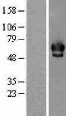 Western Blot: Chk2 Overexpression Lysate (Adult Normal) [NBL1-09147] Left-Empty vector transfected control cell lysate (HEK293 cell lysate); Right -Over-expression Lysate for Chk2.