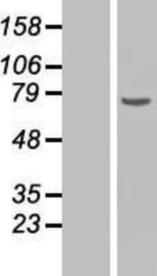 Western Blot: Chk2 Overexpression Lysate (Adult Normal) [NBP2-10753] Left-Empty vector transfected control cell lysate (HEK293 cell lysate); Right -Over-expression Lysate for Chk2.