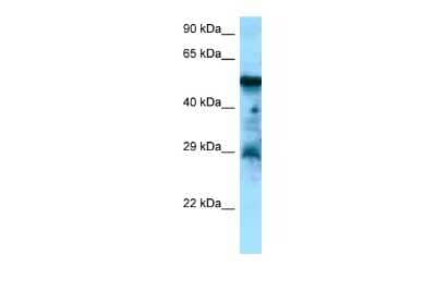 Western Blot: Cholecystokinin-B R/CCKBR Antibody [NBP2-88784] - WB Suggested Anti-CCKBR Antibody. Titration: 1.0 ug/ml. Positive Control: Placenta