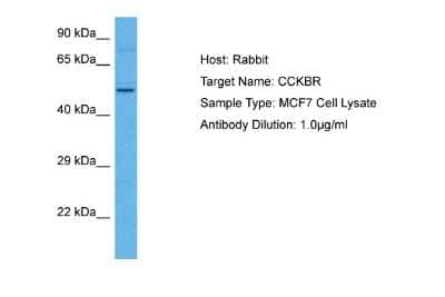 Western Blot: Cholecystokinin-B R/CCKBR Antibody [NBP2-88785] - Host: Rabbit. Target Name: CCKBR. Sample Tissue: Human MCF7 Whole Cell lysates. Antibody Dilution: 1ug/ml