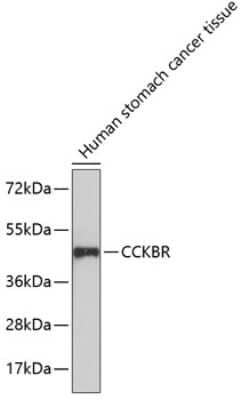 Western Blot: Cholecystokinin-B R/CCKBR Antibody [NBP3-03043] - Analysis of extracts of human stomach cancer tissue, using Cholecystokinin-B R/CCKBR antibody . Secondary antibody: HRP Goat Anti-Rabbit IgG (H+L) at 1:10000 dilution. Lysates/proteins: 25ug per lane. Blocking buffer: 3% nonfat dry milk in TBST.