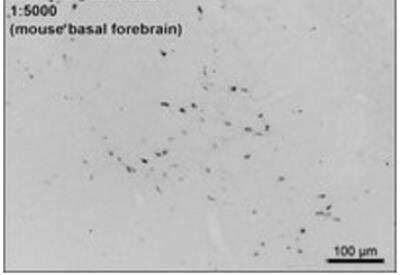 Immunohistochemistry: Choline Acetyltransferase/ChAT Antibody [NB100-40794] - Staining of PFA-perfused cryosection of Mouse Basal Forebrain. HRP-staining with Ni-DAB after Biotin-SP-antigoat amplification. Data obtained by Prof. Erik Hrabovszky, Inst, Exp, Med., Budapest, Hungary.