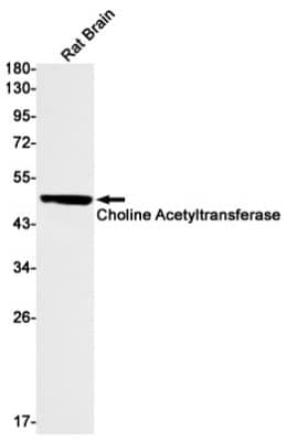 Western Blot: Choline Acetyltransferase/ChAT Antibody (S07-1G8) [NBP3-19603] - Western blot detection of Choline Acetyltransferase/ChAT in Rat Brain lysates using NBP3-19603 (1:1000 diluted). Predicted band size: 72kDa. Observed band size: 72kDa.